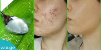 როგორ გამოვიყენოთ ალოე ვერა თავის მოვლის დროს? ეს რჩევები ყველა მანდილოსანს გამოადგება