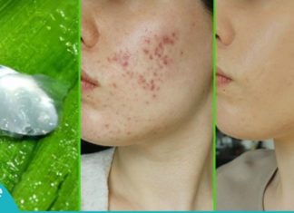 როგორ გამოვიყენოთ ალოე ვერა თავის მოვლის დროს? ეს რჩევები ყველა მანდილოსანს გამოადგება