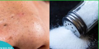 გათავისუფლდით აკნესა და შავი წერტილებისგან მარილის სკრაბით!