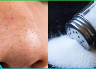 გათავისუფლდით აკნესა და შავი წერტილებისგან მარილის სკრაბით!