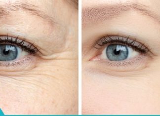 როგორ გავიქროთ მიმიკური ნაოჭები თვალების ქვეშ – ყველაზე ეფექტური ნიღბები.