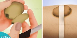 6 დაუჯერებელი მეთოდი, რომლებსაც ჩვენი ბებიები და ბაბუები იყენებდნენ. ეს ნამდვილად ეფექტურია!