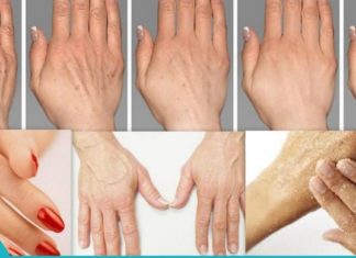 უნიკალური მეთოდი, რომელიც აახალგაზრდავებს ხელებს.