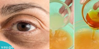 დაიტანეთ სახეზე ეს მასა, გაიჩერეთ 15 წუთი და სამუდამოდ დაგავიწყდებათ მუქი წრეები თვალების ქვეშ.