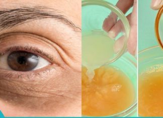 დაიტანეთ სახეზე ეს მასა, გაიჩერეთ 15 წუთი და სამუდამოდ დაგავიწყდებათ მუქი წრეები თვალების ქვეშ.