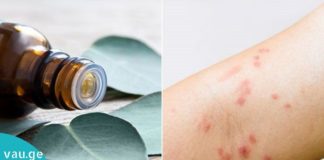 ეთერზეთი, რომელიც ებრძვის აკნეს, ეგზემას და ფსორიაზს!