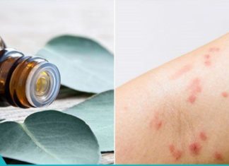 ეთერზეთი, რომელიც ებრძვის აკნეს, ეგზემას და ფსორიაზს!