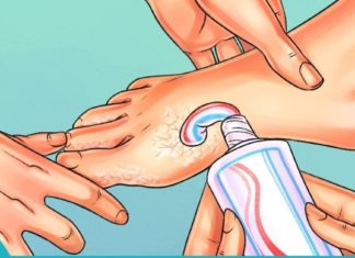 მოამზადეთ კრემი კბილის პასტისგან და წაისვით დაწოლის წინ. როდესაც გაიღვიძებთ, შედეგით გაოცდებით