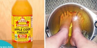 ჩააწყვეთ ფეხები ძმარში კვირაში ერთხელ და ნახავთ როგორ გაგივლით ყველანაირი ტკივილი.