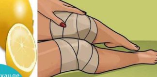 თუ გაწუხებთ მუხლების ტკივილი, დაიდეთ ლიმონი და ტკვილი გაქრება.