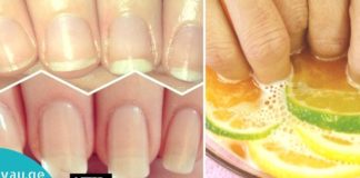 ამ ქალმა ჩაალბო ფრჩხილები ამ 2 პროდუქტის ნარევში და რამდენიმე კვირის შემდეგ, შედეგი დაუჯერებელია!