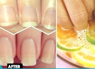 ამ ქალმა ჩაალბო ფრჩხილები ამ 2 პროდუქტის ნარევში და რამდენიმე კვირის შემდეგ, შედეგი დაუჯერებელია!