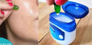 ვაზელინი და ვიტამინი E- ღამის ნიღაბი! გექნებათ სუფთა და უნაკლო კანი!