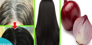 ხახვის წვენი ლიმონით – ძლიერი ბუნებრივი საშუალებები ჭაღარა თმისთვის.