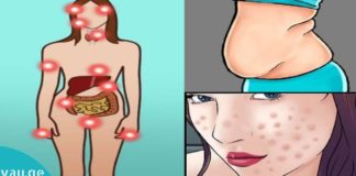 ჰორმონალური დისბალანსის სიმპტომები, რომლებსაც ხშირად ყურადღებას არ აქცევთ