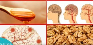 თავის ტვინის სისხლძარღვების გაწმენდის ყველაზე ეფექტური მეთოდები. მარტივია