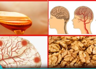 თავის ტვინის სისხლძარღვების გაწმენდის ყველაზე ეფექტური მეთოდები. მარტივია