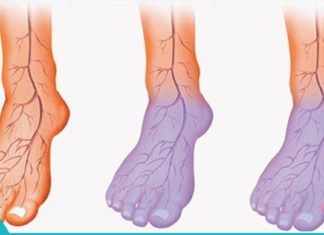 სისხლის ცუდი მიმოქცევა და ცივი ფეხები: გამომწვევი მიზეზები და მკურნალობის მეთოდები