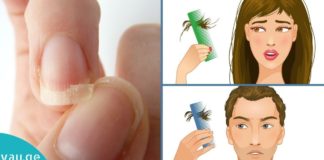 თუ თმა გცვივათ და ფრჩხილები გტყდებათ, უნდა მიიღოთ ეს ნაზავი და ყველაფერი აღდგება.