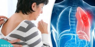 აღმოაჩინეთ ფილტვის დაავადების 10 ნიშანი, ვიდრე გვიან იქნება!