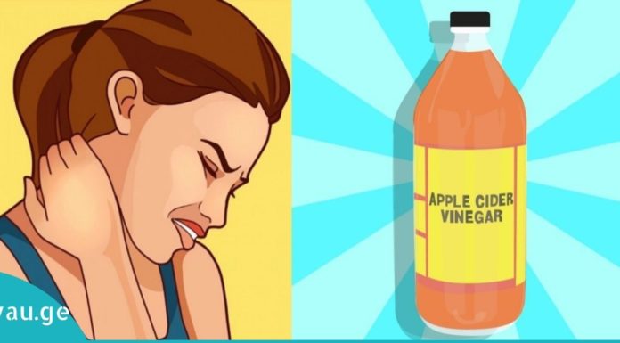 საუკეთესო საშუალებები კისრის ტკივილის გასაქრობად.