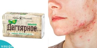 არყის ხის საპონი პრობლემური კანისთვის.