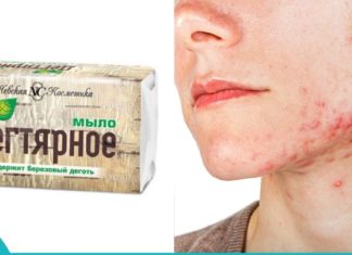 არყის ხის საპონი პრობლემური კანისთვის.