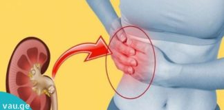 საუკეთესო მცენარეული მედიკამენტები თირკმელებში კენჭების დასაშლელად.