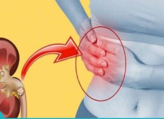 საუკეთესო მცენარეული მედიკამენტები თირკმელებში კენჭების დასაშლელად.