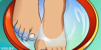 დამსკდარი ქუსლების მკურნალობის 4 რეცეპტი.