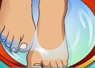 დამსკდარი ქუსლების მკურნალობის 4 რეცეპტი.