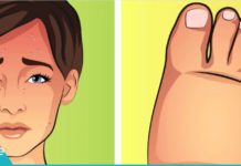 6 რამ რაც სხეულში სითხის შეკავებას იწვევს. როგორ ავიცილოთ ეს თავიდან!