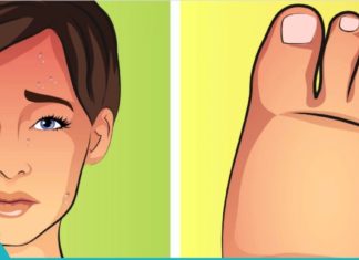 6 რამ რაც სხეულში სითხის შეკავებას იწვევს. როგორ ავიცილოთ ეს თავიდან!