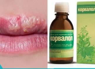 ჰერპესის მკურნალობის საუკეთესო მეთოდი-კორვალოლი!