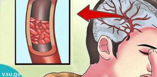 ათი ნიშანი იმისა, რომ თქვენს ორგანიზმში მაგნიუმის ნაკლებობაა… ეს ყველამ უნდა იცოდეს