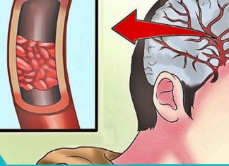 ათი ნიშანი იმისა, რომ თქვენს ორგანიზმში მაგნიუმის ნაკლებობაა… ეს ყველამ უნდა იცოდეს