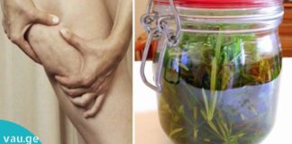 როგორ მოვამზადოთ როზმარინის სპირტი, რომ თავიდან ავიცილოთ პოდაგრა, ვარიკოზული ვენები, კუნთების ტკივილი და ცელულიტი!