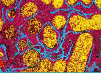 რა ახდენს გავლენას მეტაბოლიზმზე: 6 ფაქტორი.