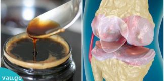 ჟელატინი და თაფლი სახსრებისთვის, რომელიც ნამდვილად ეფექტურია.