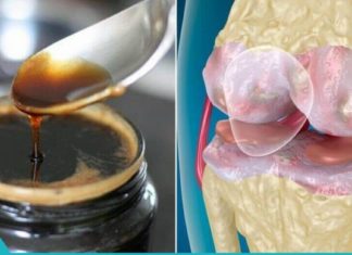 ჟელატინი და თაფლი სახსრებისთვის, რომელიც ნამდვილად ეფექტურია.