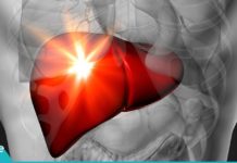 6 ჩვევა, რომლიც აზიანებს თქვენს ღვიძლს. ამის შესახებ უნდა იცოდეთ, რომ შემდეგ გვიან არ იყოს.