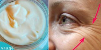 კოსმეტოლოგები შოკში არიან! ეს პოპულარული მალამო დაგეხმარებათ ნაოჭები 1 ღამეში გააქროთ!