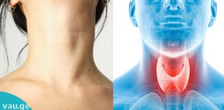 ფაფა, რომელსაც შეუძლია ფარისებრი ჯირკვლის განკურნება!