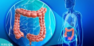 სუპერ-სკრაბი ნაწლავებისთვის- მინუს 11 კგ ერთ თვეში! არ დავიჯერებდი, თვითონ რომ არ გამომეცადა!