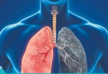 ფილტვების გაწმენდა გაცივების შემდეგ, სიგარეტის კვამლისგან და დაბინძურებული ჰაერისგან.