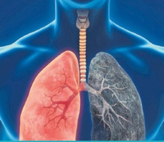 ფილტვების გაწმენდა გაცივების შემდეგ, სიგარეტის კვამლისგან და დაბინძურებული ჰაერისგან.