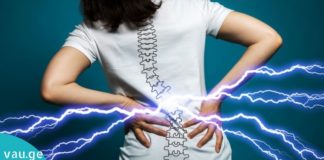 აი რატომ გტკივათ ზურგი! გაიგეთ მეტი მიზეზების და პრევენციის შესახებ!