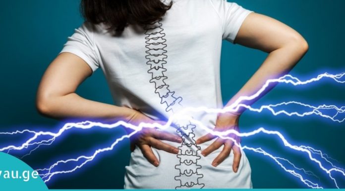 აი რატომ გტკივათ ზურგი! გაიგეთ მეტი მიზეზების და პრევენციის შესახებ!