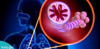 დაივიწყეთ ძვირადღირებული წამლები! ეს საუცხოო წვენი არაჩვეულებრივია ასთმის დროს.