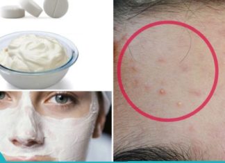 როგორ შეუძლია ასპირინის ორ ტაბლეტს დაგეხმაროთ ლაქების, ნაოჭების და ნაწიბურების მოცილებაში.